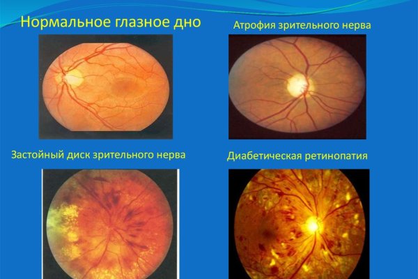 Mega darknet ссылка